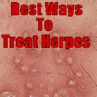 Herpes treatment